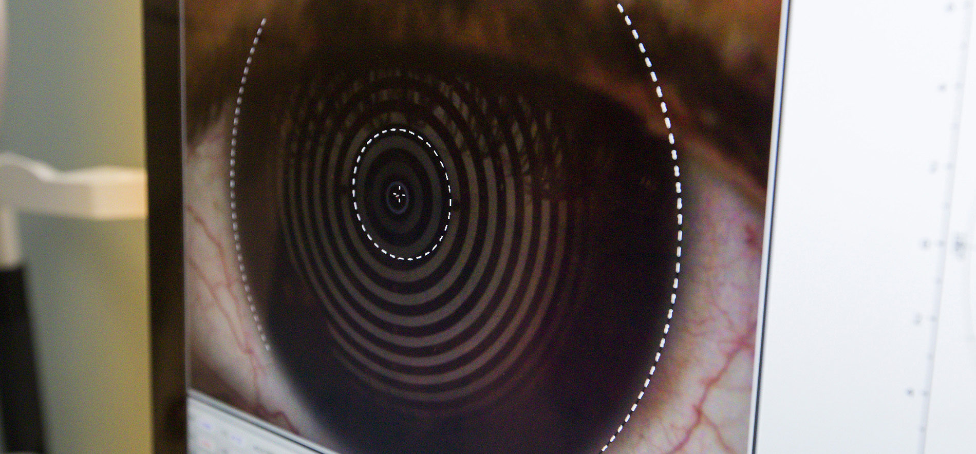 Why Optometry New England College Of Optometry