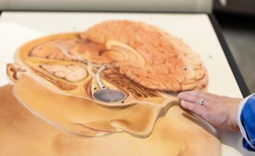 CLOSE-UP PHOTO OF TACTILE IMAGE DEPICTING THE VISUAL SYSTEM